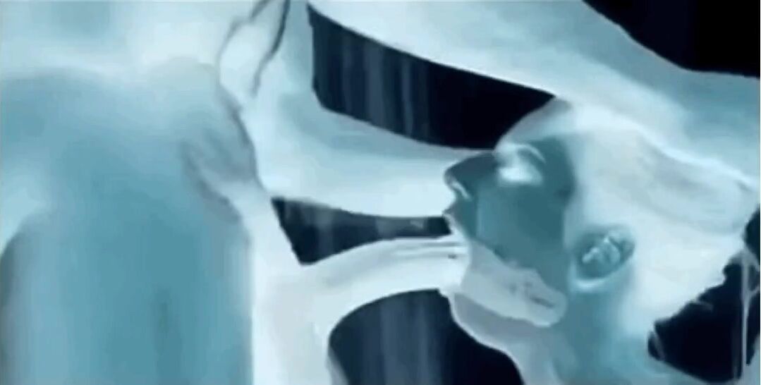 X-Ray’ted